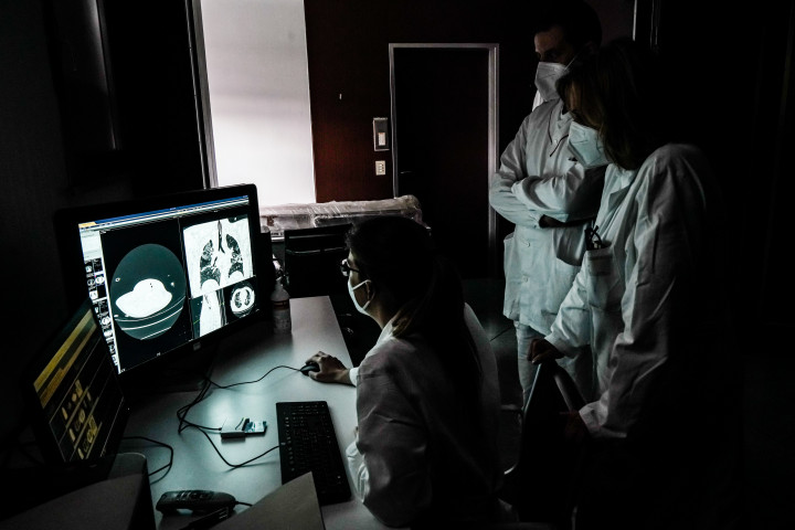 Egy koronavírussal fertőzött beteg tüdejéről készült CT-képet vizsgálnak orvosok egy olaszországi kórházban 2020 júniusában – Fotó: Nicola Marfisi / AGF / Universal Images Group / Getty Images