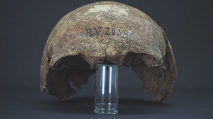 A férfi a koponya alapján valószínűleg 20-30 év körüli lehetett – Fotó: DOMINIK GOLDNER, BGAEU, BERLIN