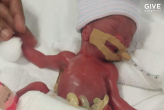 13 hónap kórház után hazaengedték a valaha mért legkisebb súllyal született csecsemőt