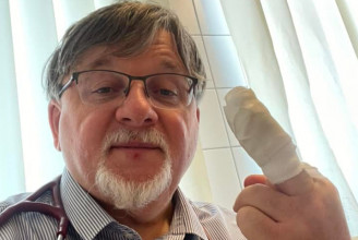 Házimunka közben vágta meg magát a győri polgármester, majd félreérthető módon posztolt a sérült ujjáról